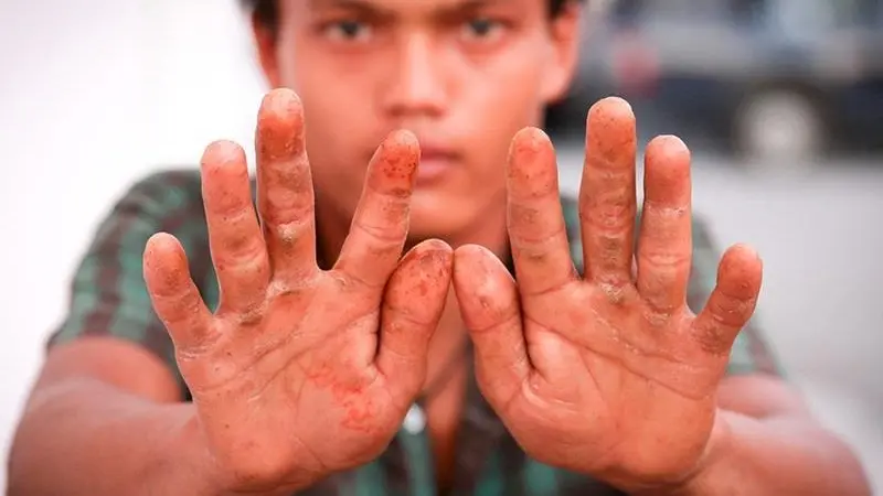 Reports of assault, threats at gunpoint and beatings by shelter staff leading to severe injuries have been recorded by EJF