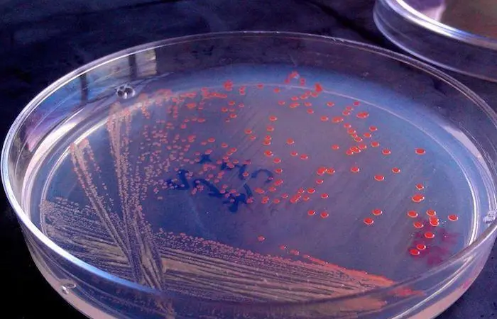 Advances in aquaculture will help meet the protein needs of a growing population Photo: KnipBio
