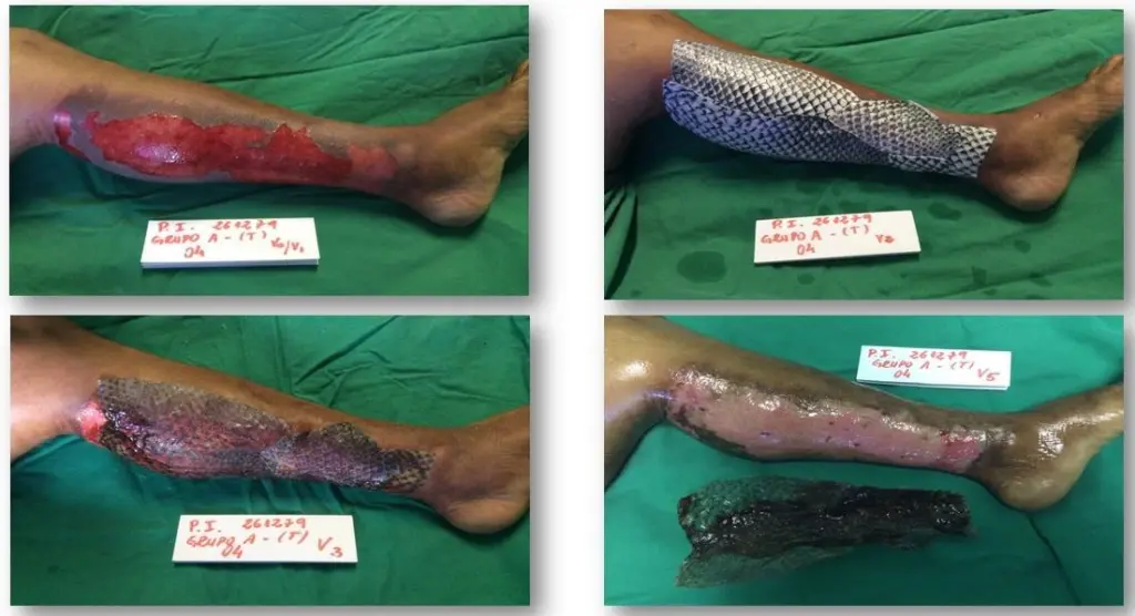 Tilapia Healing