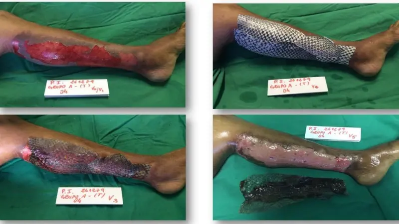 Tilapia Healing
