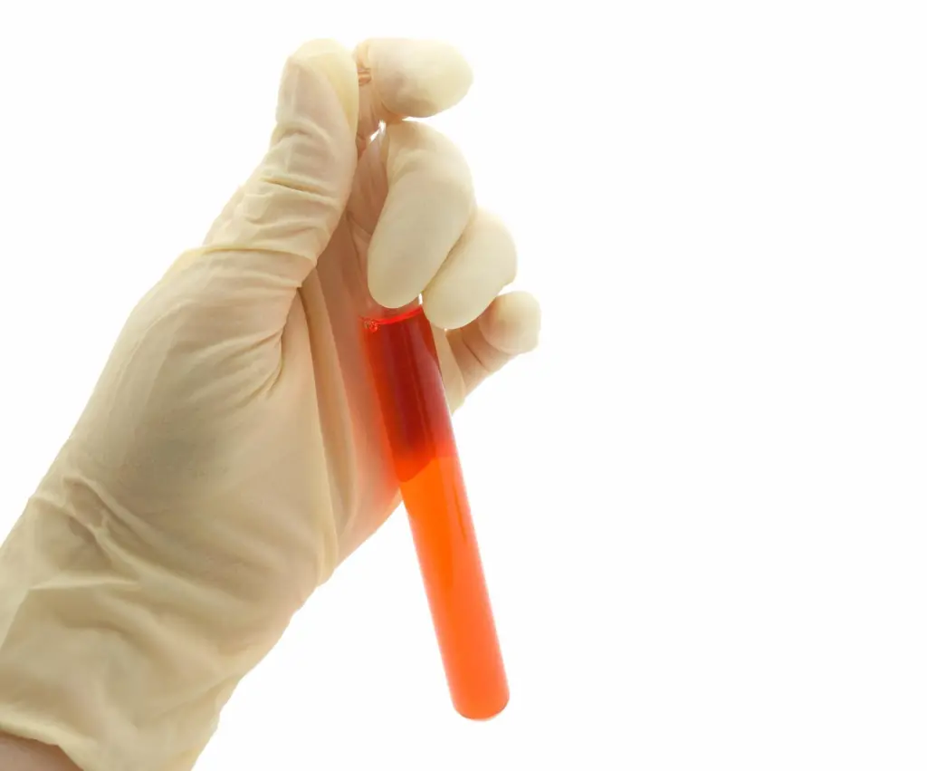 Salmon Blood