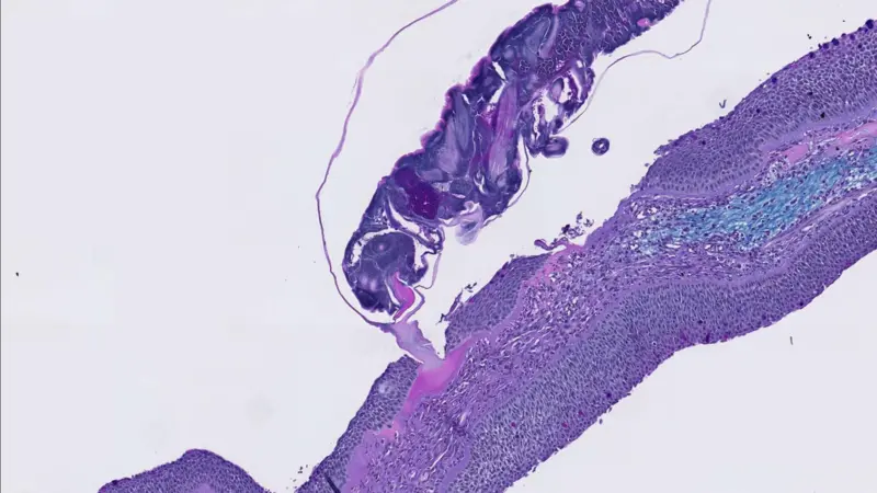 A sea louse (on top) attaches itself to a fish fin